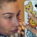 How to make acne disappear in one hour, one day and one week